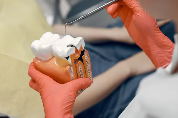 Fillings and Restorations